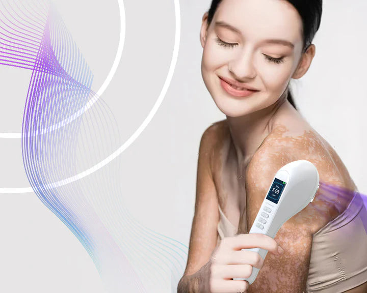 Combattre le vitiligo grâce à la luminothérapie rouge