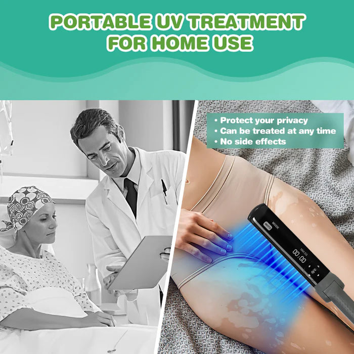 KTS 311nm UVB light therapy treatment for psoriasis vitiligo