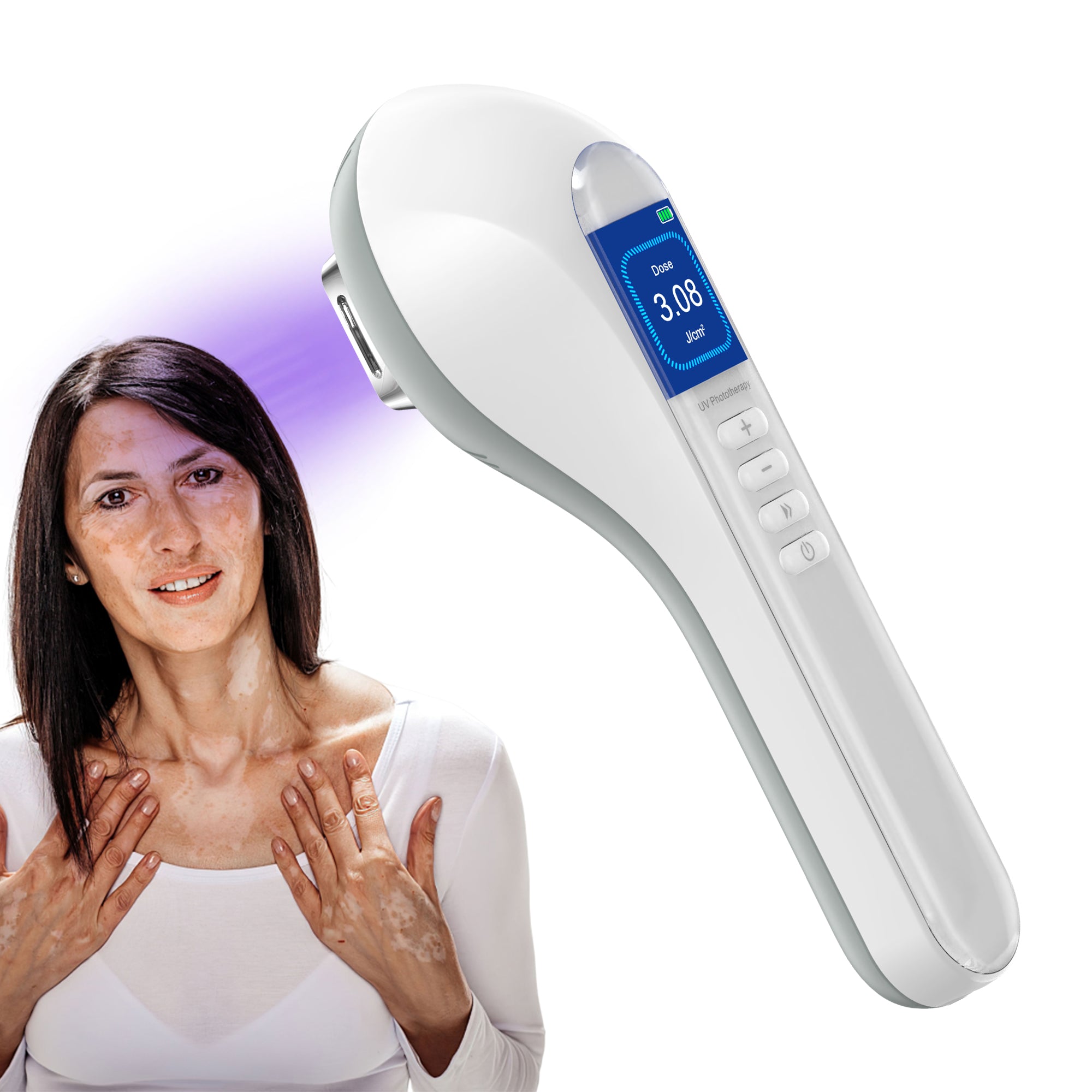 Appareil de luminothérapie portatif UVB pour vitiligo/psoriasis KTS