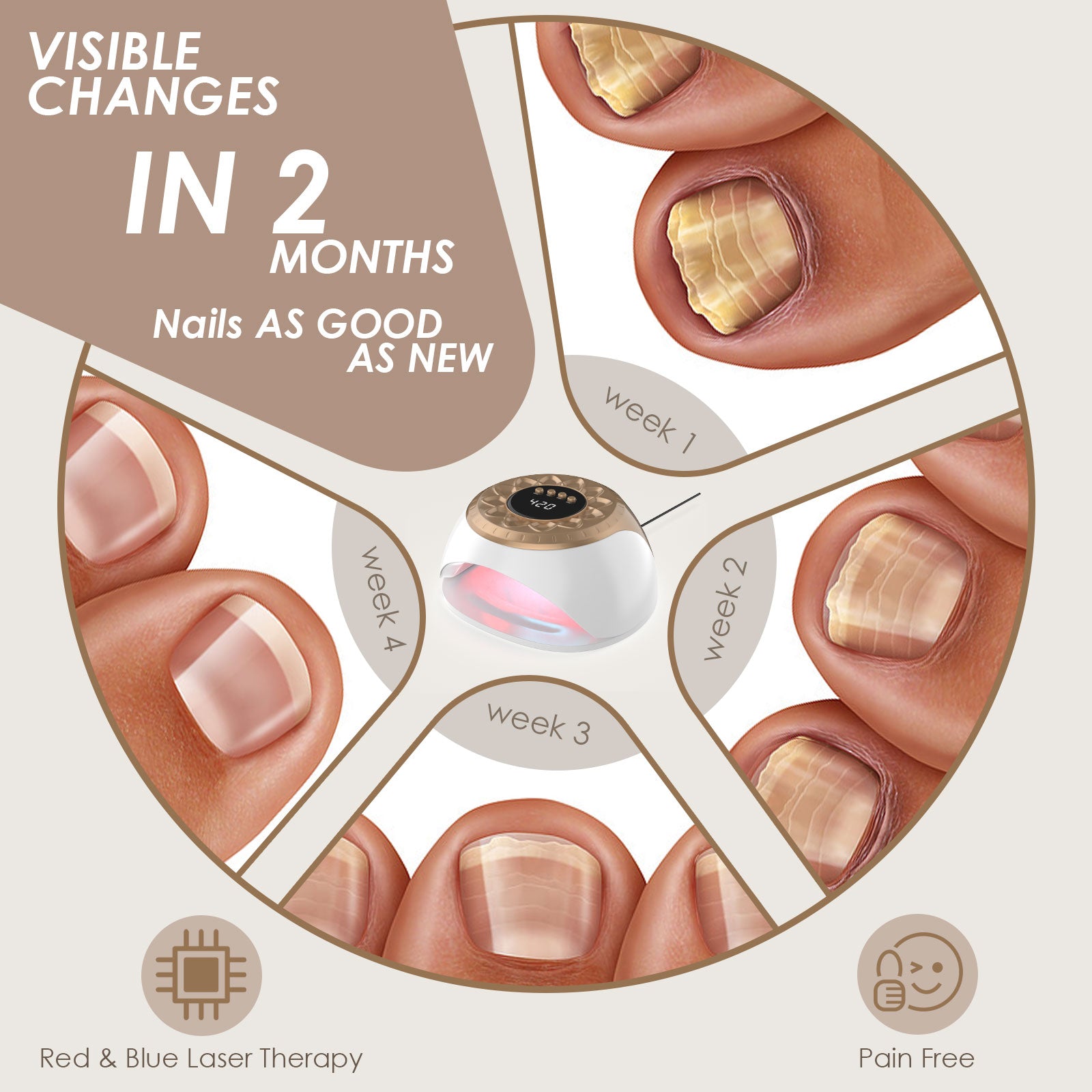 Gold KTS Nail Fungus Light pour les ongles multiples
