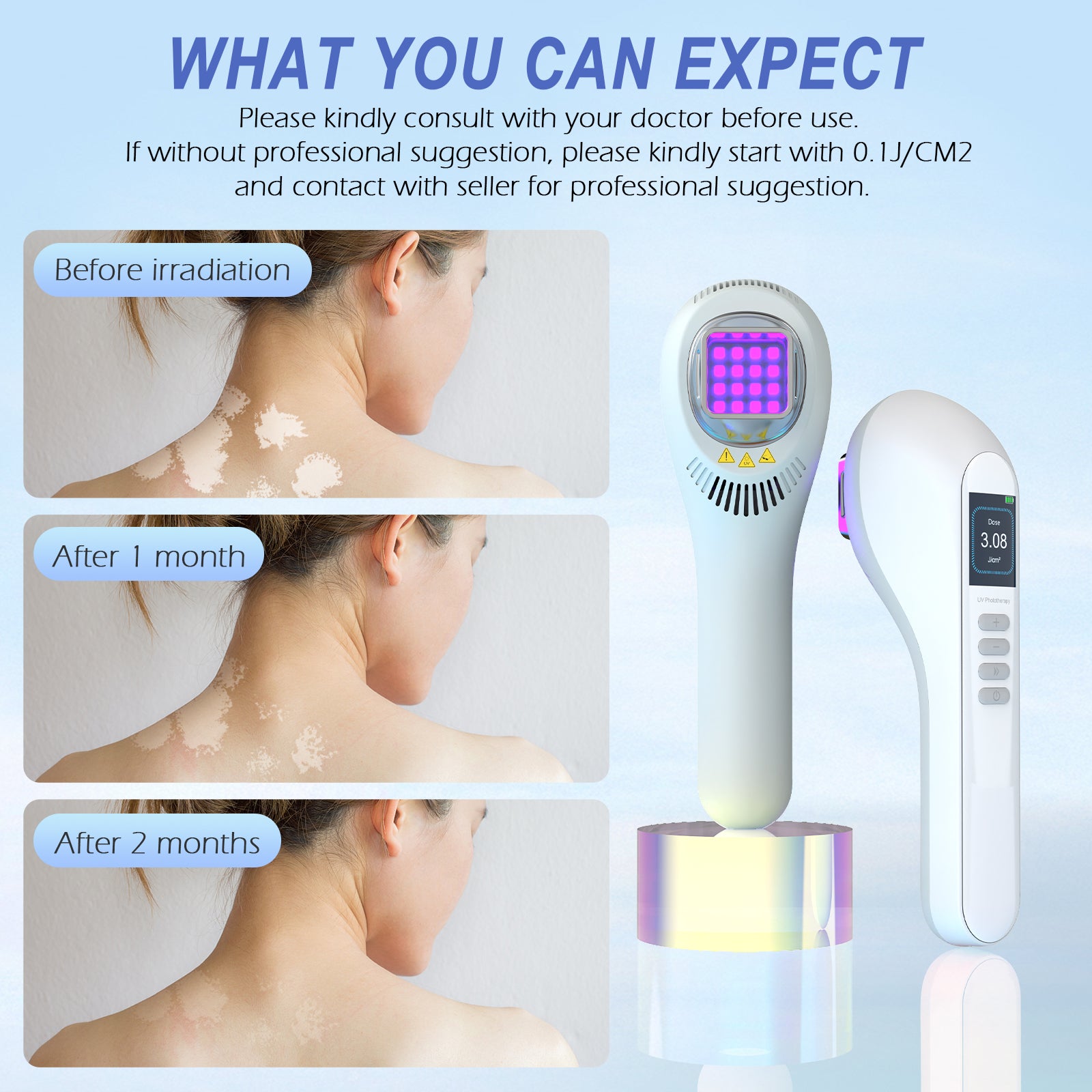 Appareil de luminothérapie portatif UVB pour vitiligo/psoriasis KTS