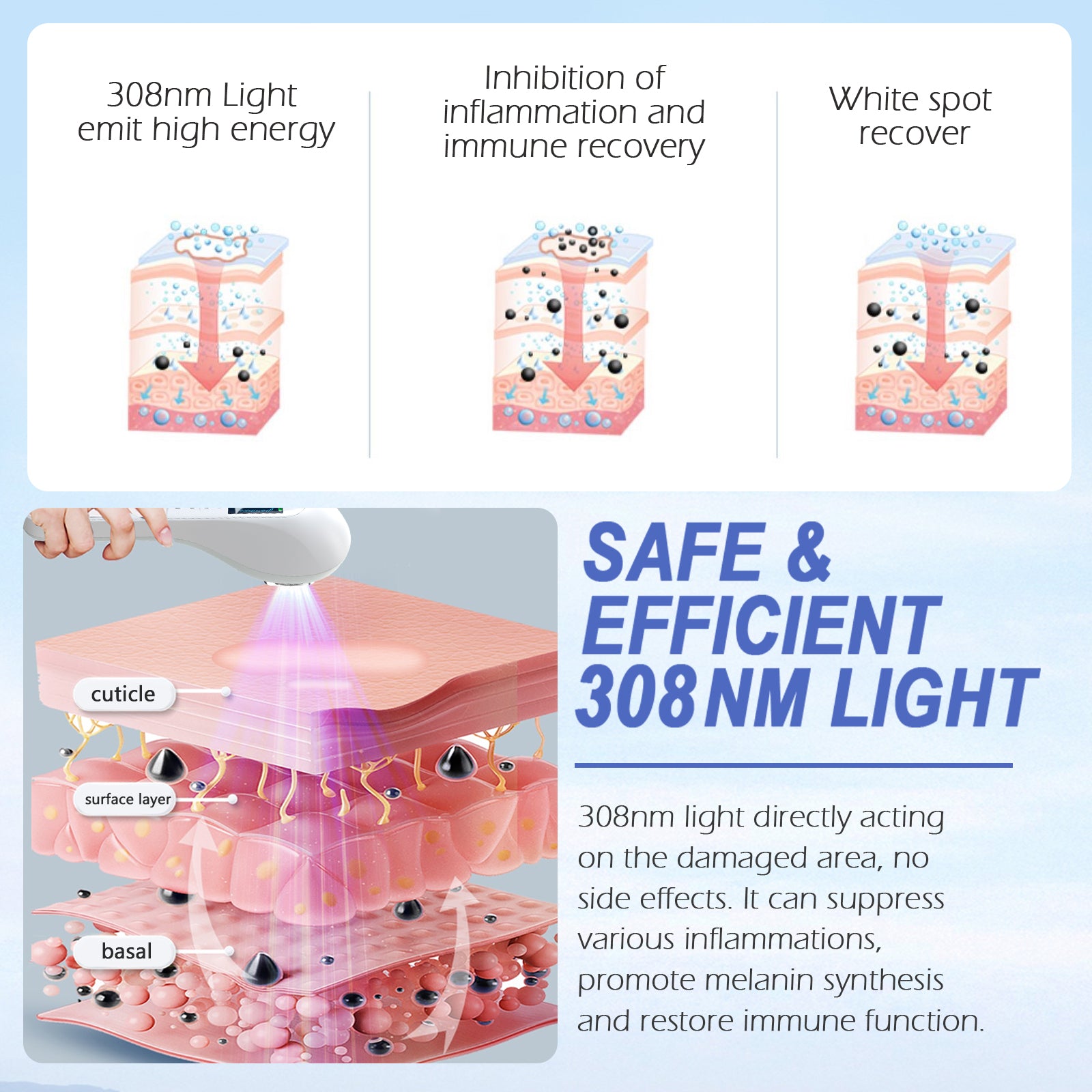 Appareil de luminothérapie portatif UVB pour vitiligo/psoriasis KTS