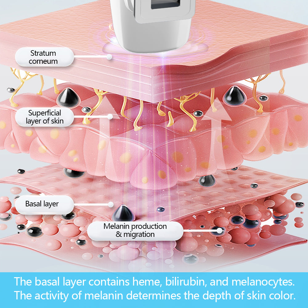 Appareil de thérapie par lumière excimère UVB 308nm KTS
