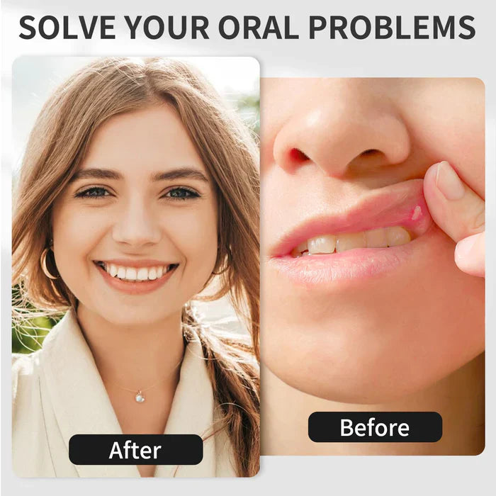 Appareil de thérapie orale à lumière rouge KTS®