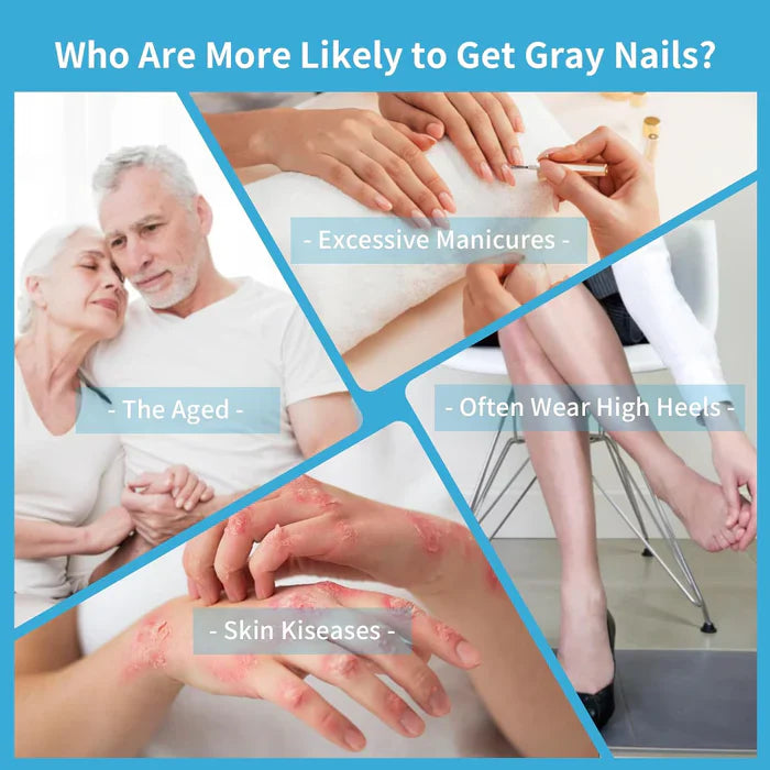 Appareil de traitement au laser pour les champignons des ongles KTS®