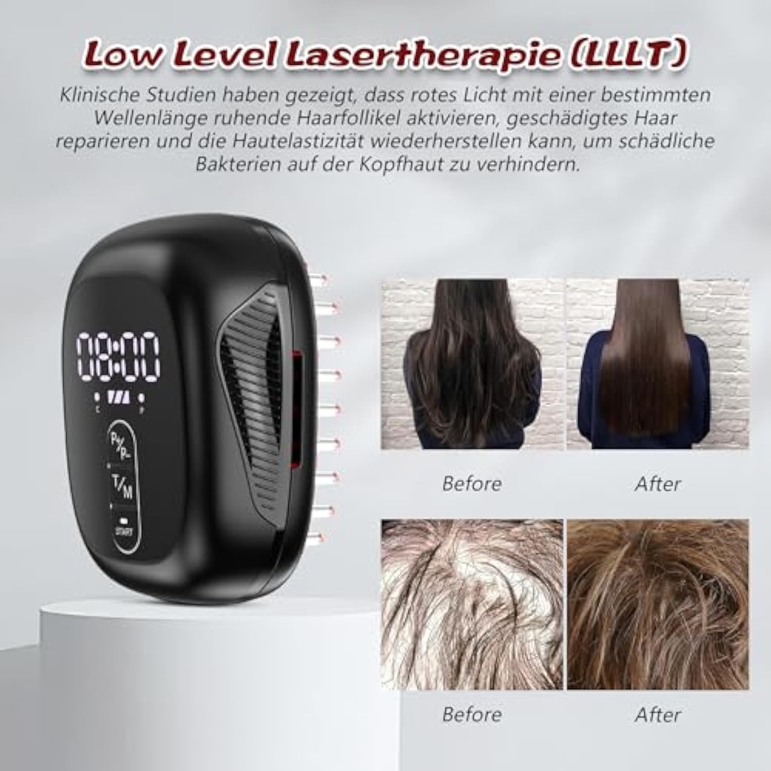 KTS Peigne de croissance des cheveux au laser à lumière rouge et froide