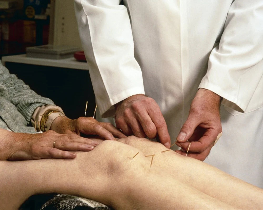 Comparaison de la luminothérapie rouge et de l'acupuncture pour soulager la douleur