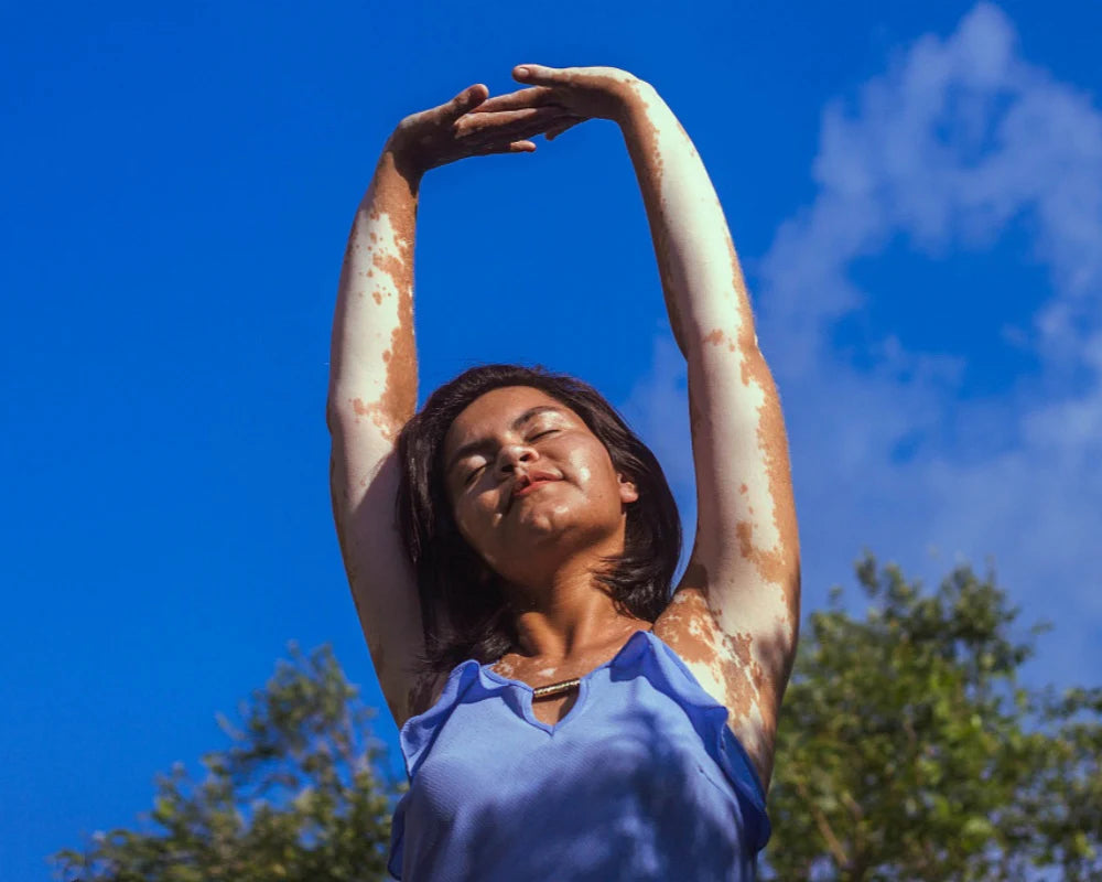 La photothérapie UVB peut-elle traiter le vitiligo ?