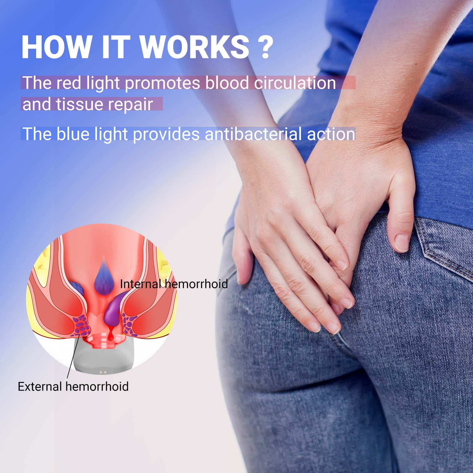 Appareil laser portable pour le traitement des hémorroïdes