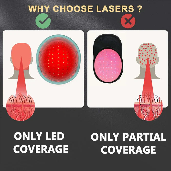 Capuchon laser pour traitements de repousse des cheveux KTS®