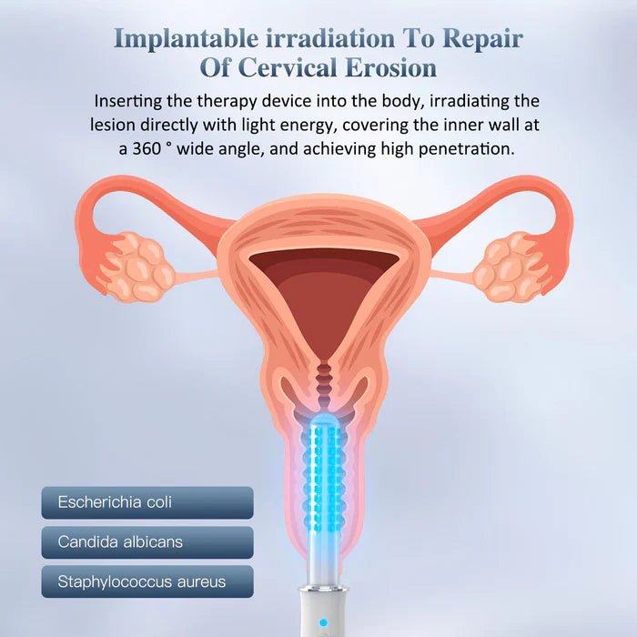 Baguette de rajeunissement vaginal portable KTS®