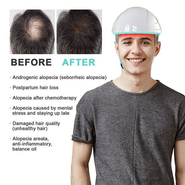 Capuchon laser pour traitements de repousse des cheveux KTS®