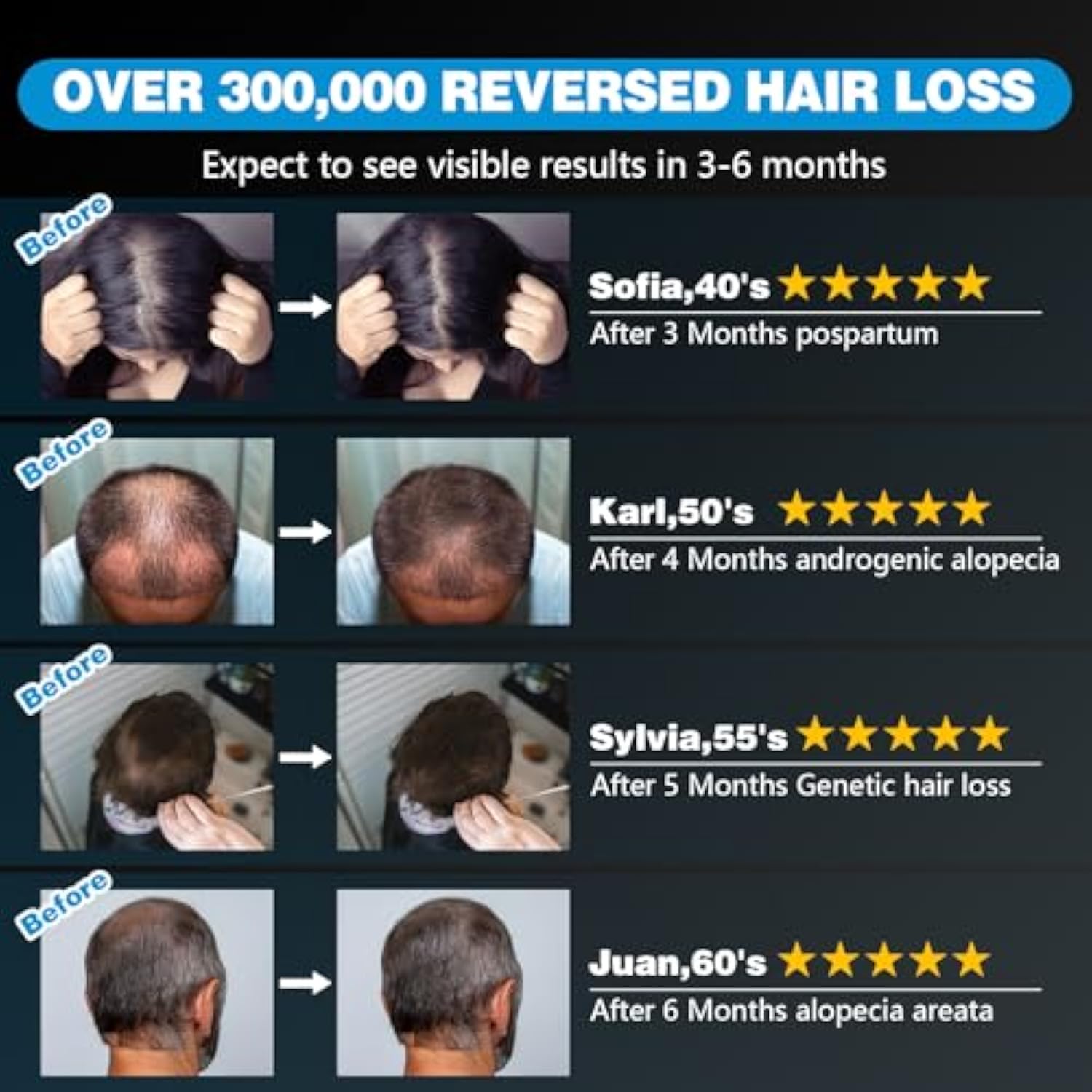 KTS® Laser Capuchon de repousse des cheveux 1.0 Pro